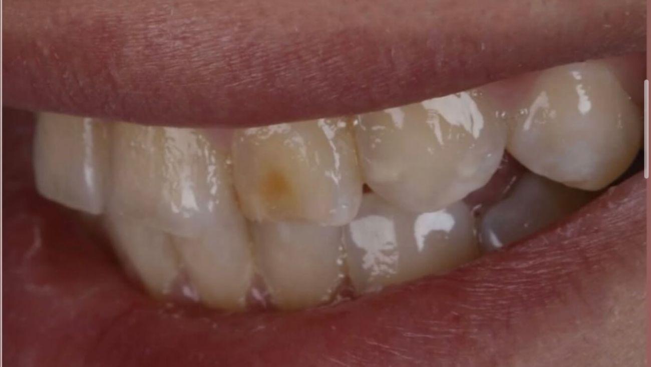 Before Aesthetic Dentistry