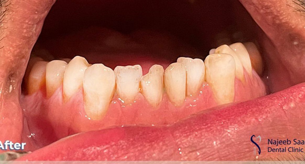 After General Dentistry
