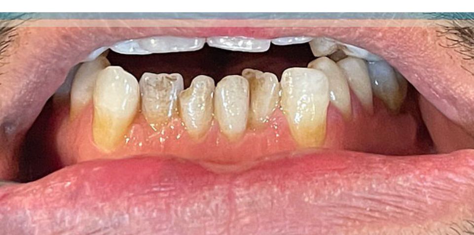Before General Dentistry