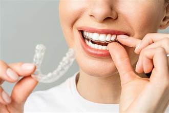Invisible Aligners in Karachi at Najeeb Saad Dental Clinic