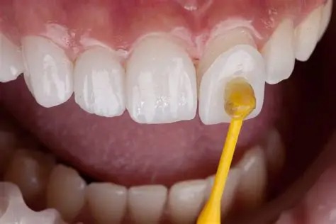 Cosmetic Dentistry in Karachi at Najeeb Saad Dental Clinic