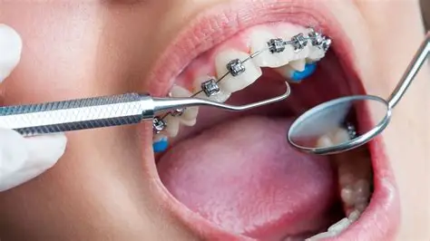 Orthodontic in Karachi at Najeeb Saad Dental Clinic