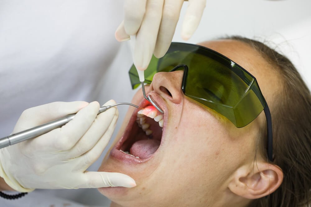 Gum Treatment in Karachi at Najeeb Saad Dental Clinic
