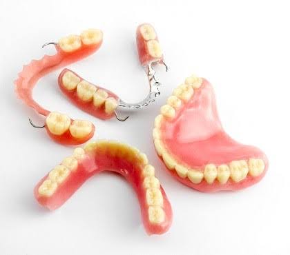 Denture in Karachi at Najeeb Saad Dental Clinic
